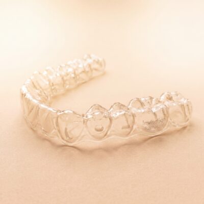 Niềng răng Invisalign